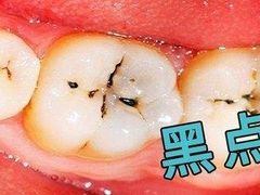 -团圆口腔·种植中心(锦江院区)