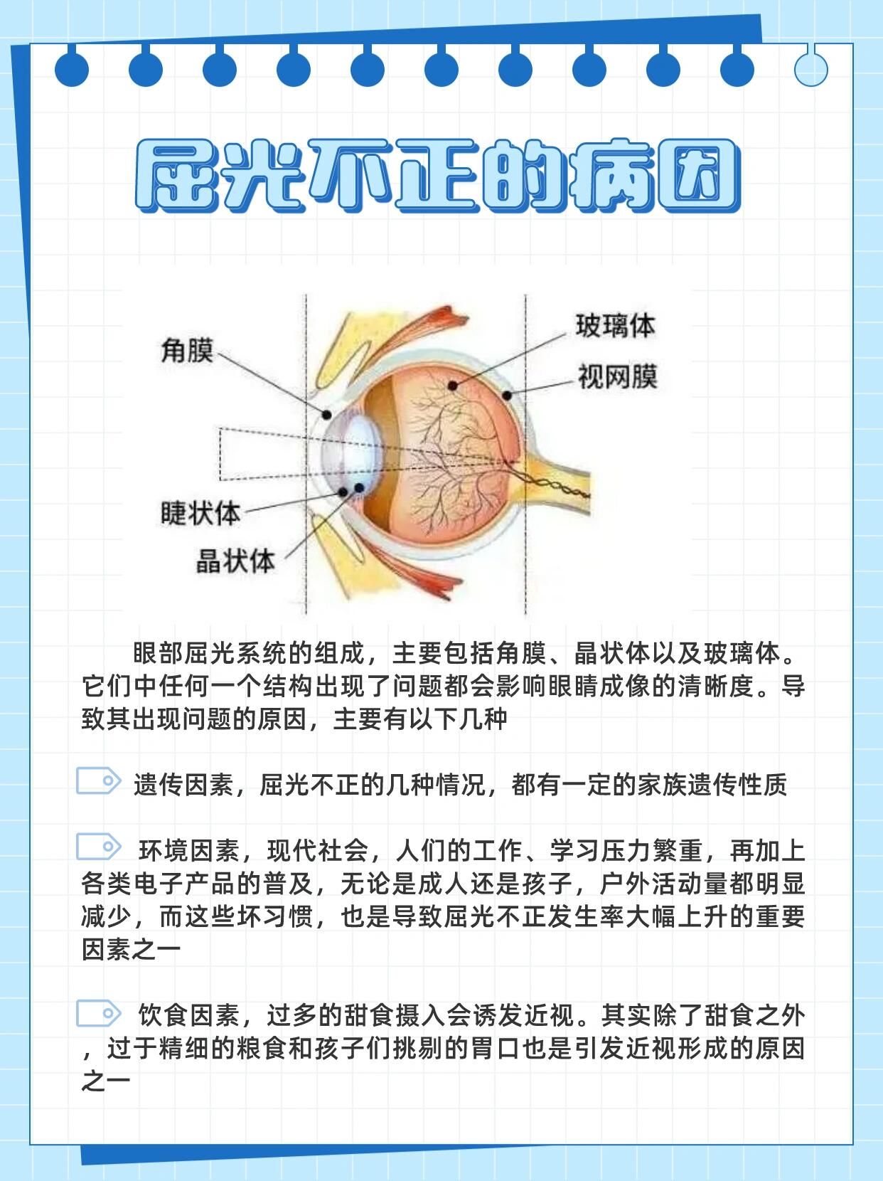 n👉什么是屈光不正
屈光不正,光线通过眼睛的屈光系统会发生