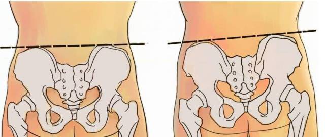 骨盆正位