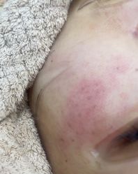 -宁波美莱整形美容