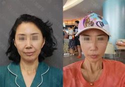 -加减美医美连锁品牌