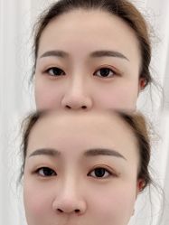 -久匠·纹眉纹绣半永久