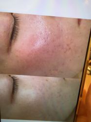 -苑苑vbeauty科技美容SPA