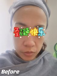 点击看大图 -天津健丽·去眼袋医疗美容机构