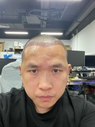 -大麦微针植发全国连锁