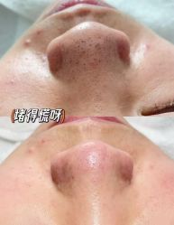 -春田皮肤管理中心品牌旗舰店