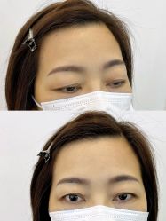 点击看大图 -杨益美学·野生眉半永久纹眉发际线