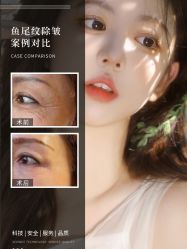 -万阡国际专业祛斑·祛痣·祛疤连锁