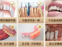 -团圆口腔·种植中心(锦江院区)
