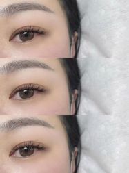 -U-Nail