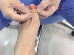 -Andrew指甲专科灰指甲·甲沟炎矫正·3D步态矫形鞋垫定制(浦三路店)