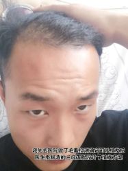 -雍禾植发全国连锁