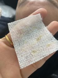 -瑶芳清颜草本祛痘