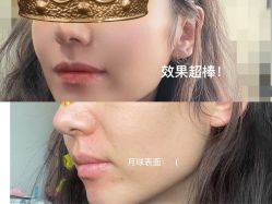 体验前-北京英煌医疗美容