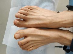 -派恩宜灰指甲(勤业店)