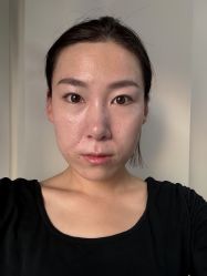 -成都西区医院整形美容