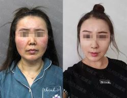 -加减美医美连锁品牌