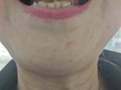 -极光口腔·矫正种植修复(锦江院区)