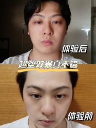 点击看大图 -美莱医学美容医院