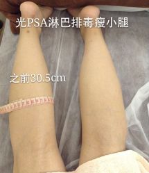 光SPA热力塑瘦身-光SPA科技美肤