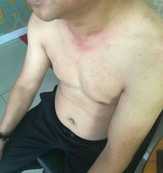 -痣清宫祛斑祛痣连锁店