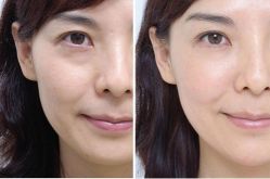 -CMS西美斯·美式医疗美容