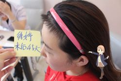 -大麦微针植发丨全国连锁