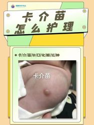 -明昇月子中心(番禺万达广场店)