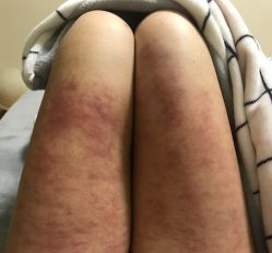 -摩瘦纤体订制减肥