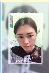 -大麦微针植发全国连锁
