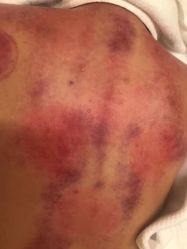 -苑苑vbeauty科技美容SPA