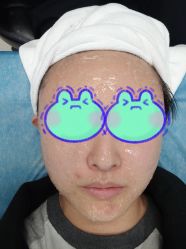 体验后-云南吴氏嘉美医疗美容医院