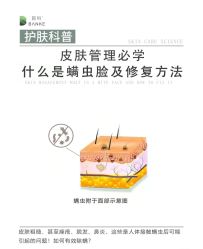点击看大图 -SKIN79皮肤管理中心