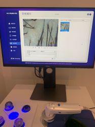 -大麦微针植发丨全国连锁