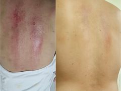 -感智盲人按摩·艾灸·肩颈SPA(岗厦店)