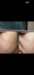 点击看大图 -苑苑vbeauty科技美容SPA