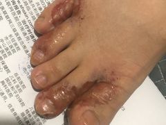 -上海市皮肤病医院(武夷路院区)