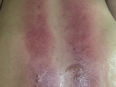 -益友堂盲人推拿正骨穴位按摩工作室