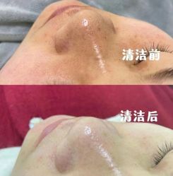 -LUNA皮相美·骨相美高级美感