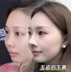 -恒博天姿医疗美容