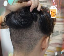 -大麦微针植发全国连锁