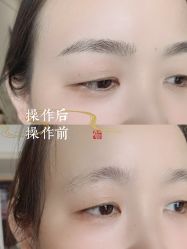 点击看大图 -西施无菌半永久纹绣眉眼影唇轻增发纹发际线