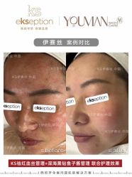 -VE专注问题肌·赛诺龙&科学美肤中心