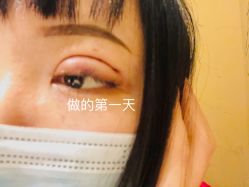 点击看大图 -铂特丽医美·眼鼻整形·光电美肤·注射抗衰