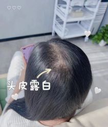 -丝源发型