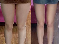 -Fundi张玉珊修身堂·indiba·BTL科技瘦身