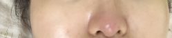 -E.beauty驻颜·痘敏肌调理中心