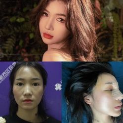 -成都西区医院整形美容