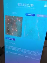 -skin79皮肤管理中心