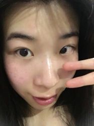 -香榭丽舍·海菲秀·皮肤管理痘敏肌修护